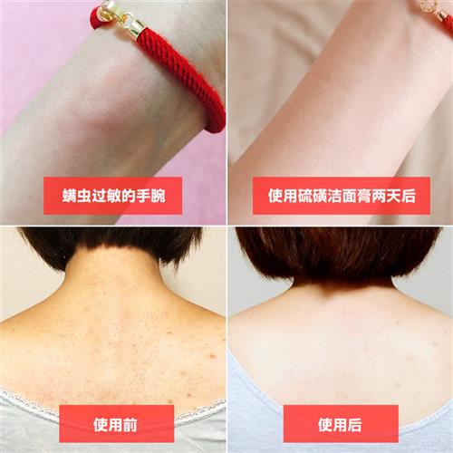 日本硫磺皂洁面膏清洁除螨虫祛痘痘粉刺闭口洗面奶