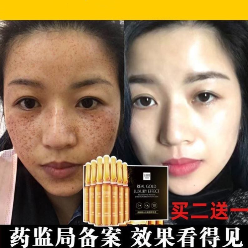 神奇原液液补水白美谈斑小安瓶精华液安平李佳琪琦推荐