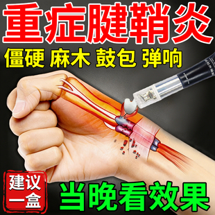 杏元 郎腱鞘炎专用膏药手腕囊肿鼓包手指关节疼痛大拇指腱鞘炎凝胶