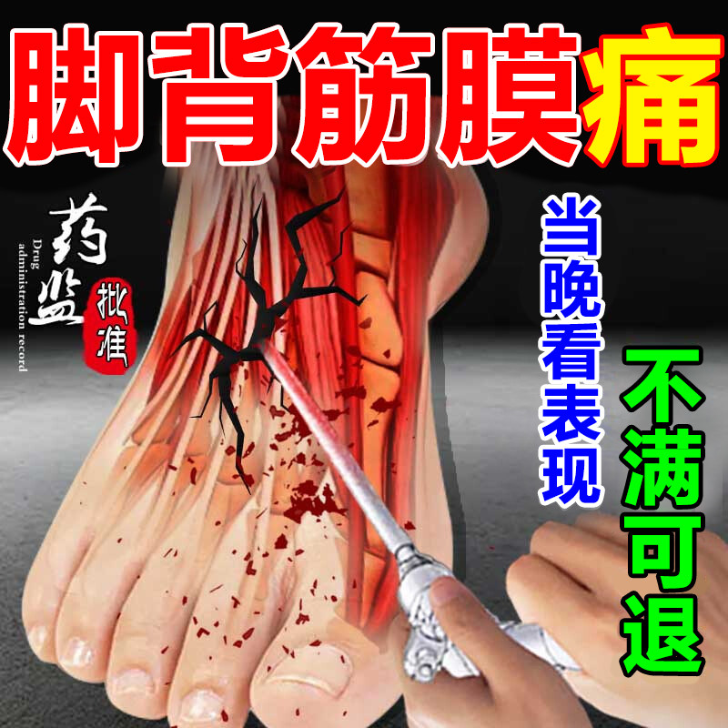 脚背筋膜炎专用膏药贴崴脚扭伤脚背脚面脚底板疼痛肿胀足底筋膜痛,医疗器械,膏药贴（器械）,淘宝优惠券,粉丝福利购,淘宝优惠卷