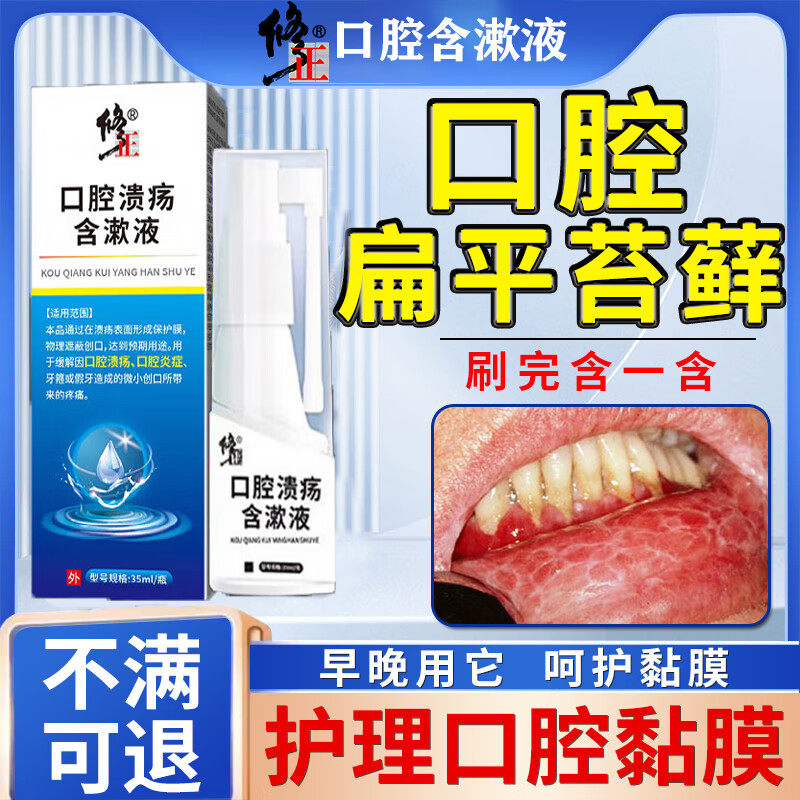 口腔溃疡专用口腔扁平苔藓喷剂口腔粘膜白斑修护舌头疼痛溃烂喷雾