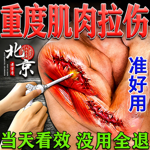 肌肉拉伤膏药贴手臂大小腿肌肉酸痛运动损伤韧带拉伤软组织修复贴