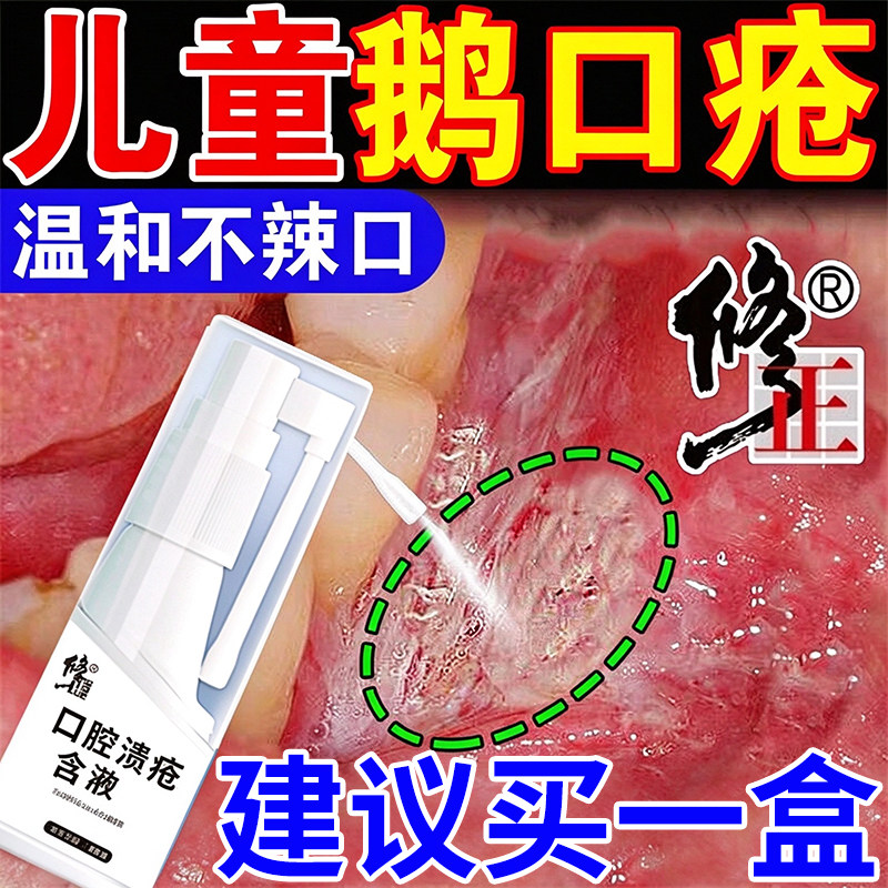 修正鹅口疮婴儿喷雾口腔溃疡专用儿童嘴巴溃烂起泡白斑含漱液