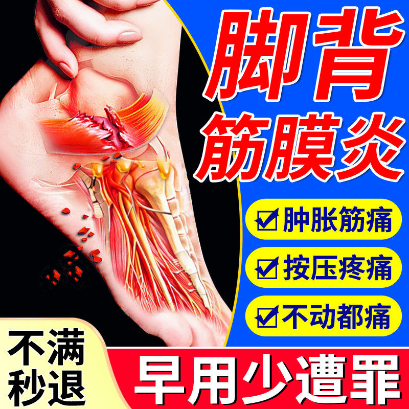 脚背筋膜炎专用膏药贴崴脚扭伤脚背脚面脚底疼痛肿胀足底筋膜痛M,医疗器械,膏药贴（器械）,淘宝优惠券,粉丝福利购,淘宝优惠卷