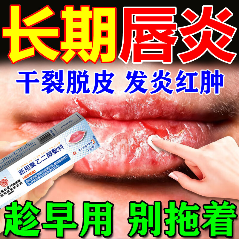 唇炎润唇膏嘴唇干裂脱皮专用保湿滋润去死皮口角炎疱疹医用修护膏,医疗器械,医用乳膏（器械）,淘宝优惠券,粉丝福利购,淘宝优惠卷