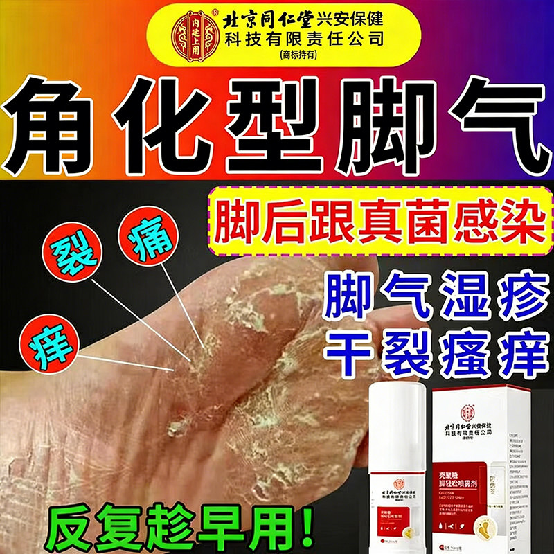 北京同仁堂角化型脚气角质增厚顽固性真菌感染壳聚糖脚轻松喷雾剂