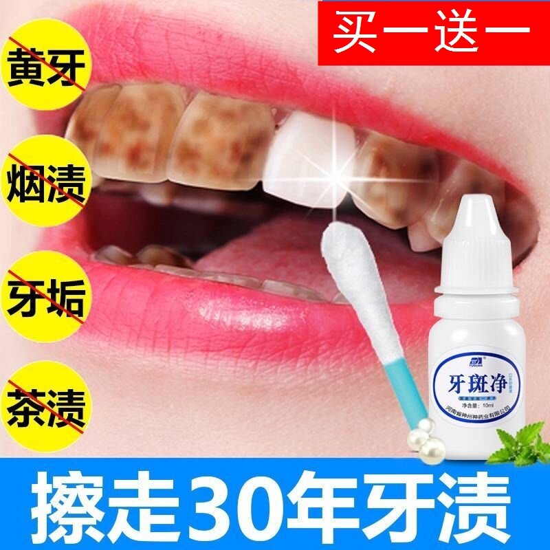 牙斑净速效去除黑黄牙渍牙齿美白神器烟渍菌斑变白亮白洁白氟斑牙
