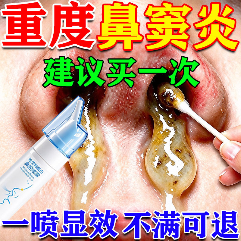 鼻窦炎排脓喷雾剂过敏性鼻炎息肉通窍鼻涕倒流喉咙儿童洗鼻喷雾剂