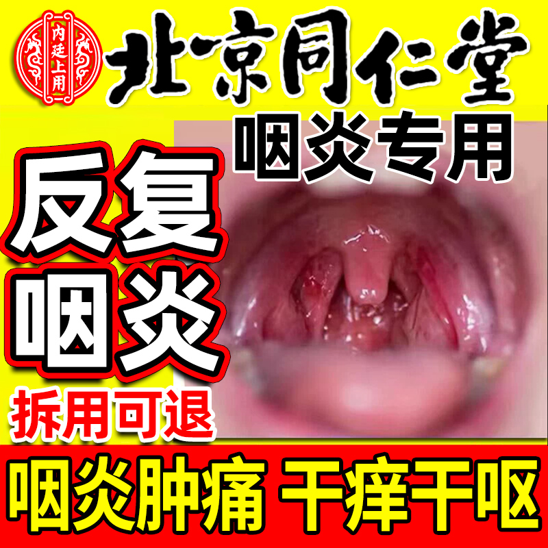 专攻咽炎！品牌有保障！放心购！