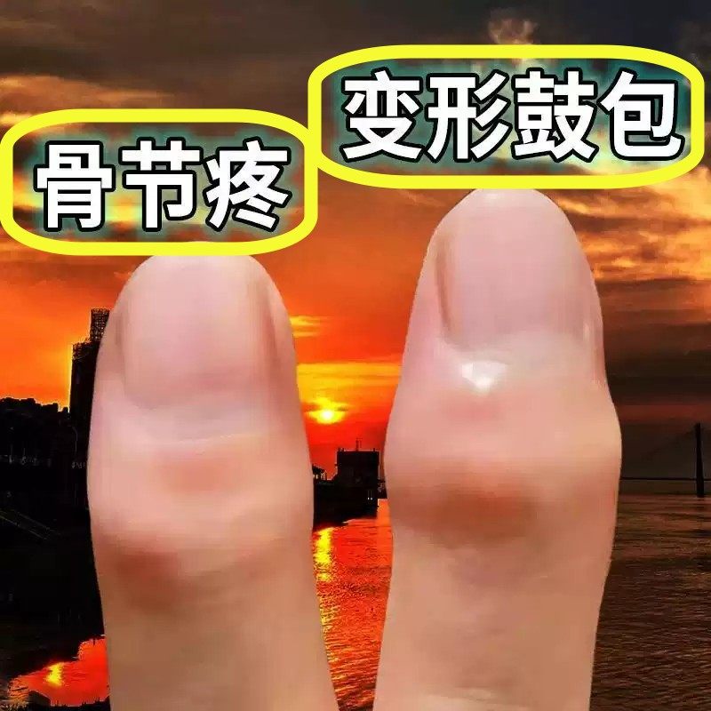 止手指关节专用类风湿骨性关节僵硬变形肿大热敷特膏疼贴
