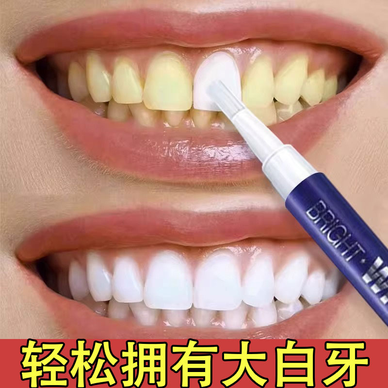 美牙笔牙贴美白牙齿去黄牙速效洁白炫白去烟茶渍变白增白神器凝胶