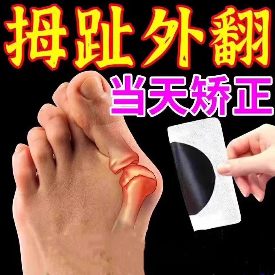 拇指外翻矫正器脚趾足大母趾外翻矫正药膏贴非矫正神器可穿鞋专用