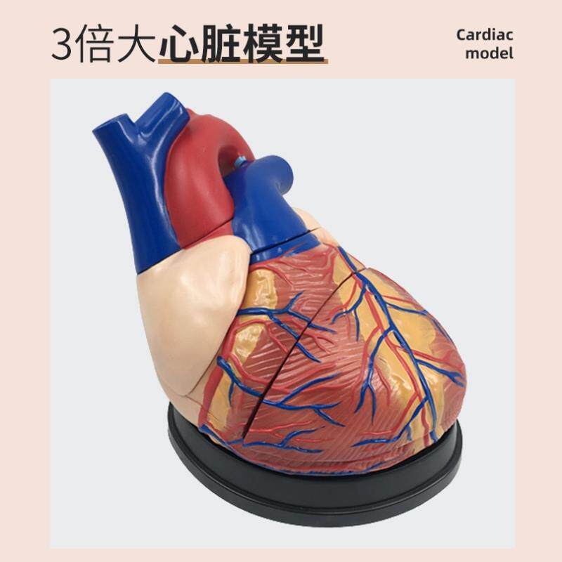 人体心脏模型四阶段血栓可拆卸冠状动脉心血管血液循环解剖器官