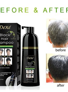 DEXE染发剂一支黑植物本草染护合一遮盖白发男女染发400ml正品店