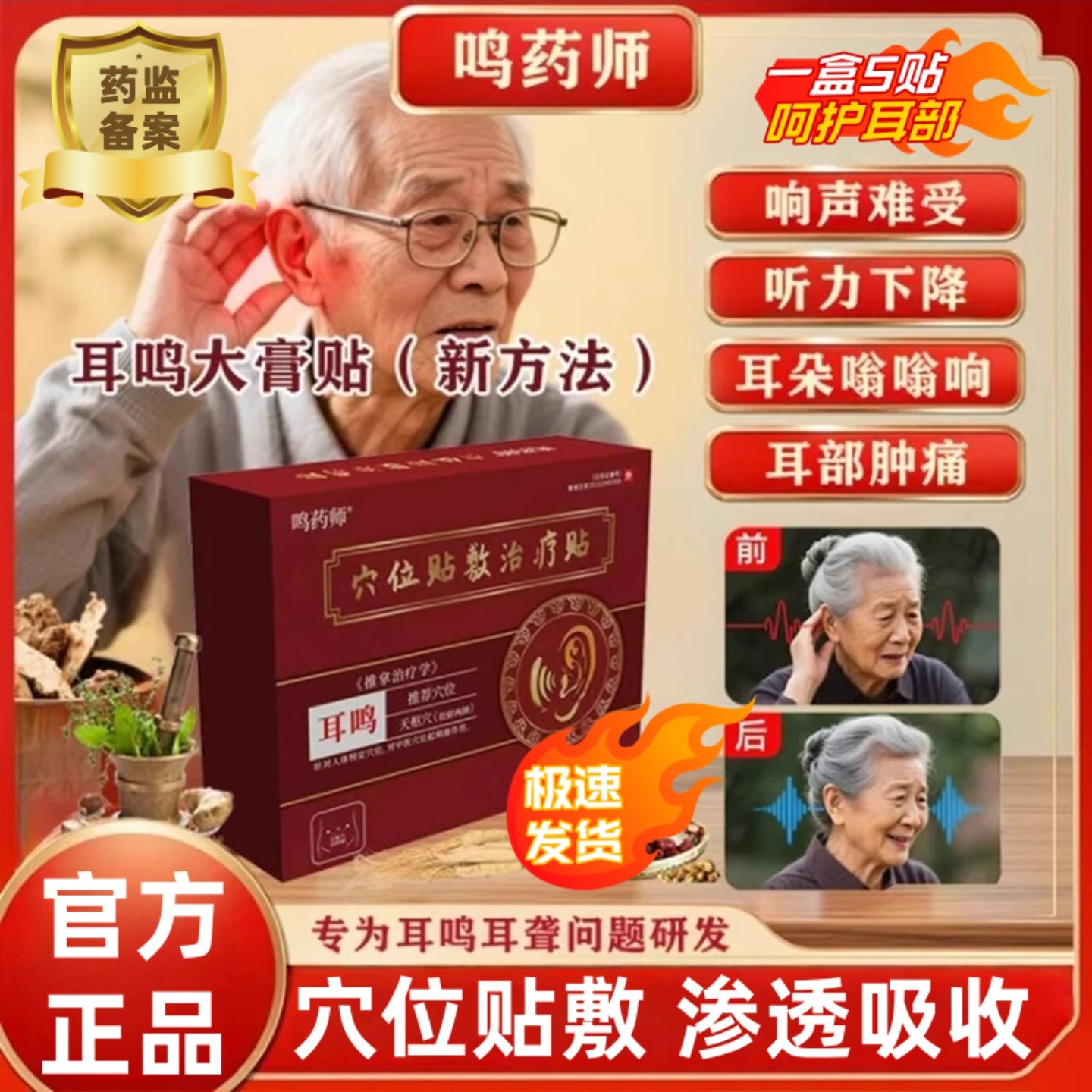 鸣药师穴位贴耳鸣耳聋耳部肿痛听力下降穴位刺激贴官方正品