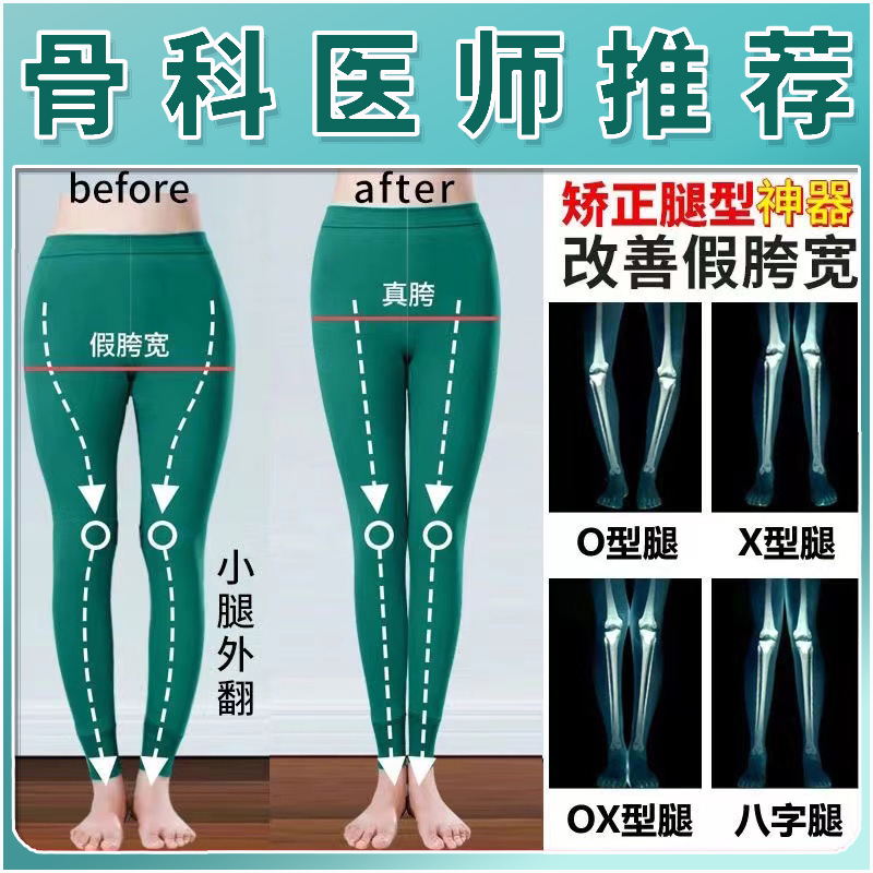 H磁疗波O型腿矫正神器小腿外翻XO型腿矫正腿型足外翻鞋垫直腿长腿