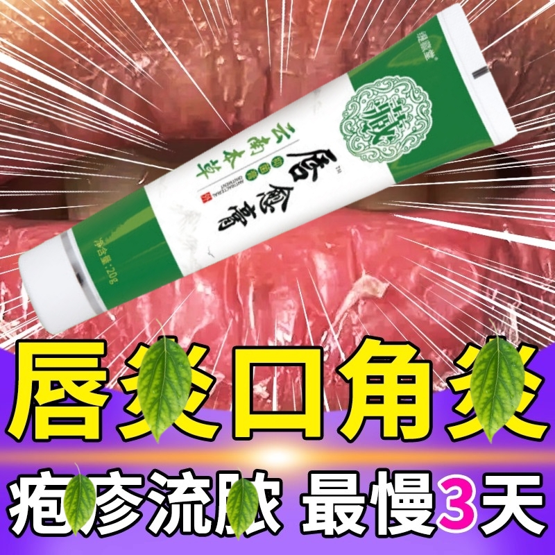 嘴巴上火起泡烂嘴角药膏嘴唇干裂脱皮结痂红肿痒口周唇部炎润唇膏