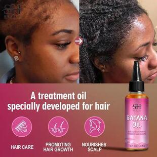 非洲快速头发生长Chebe发油BATANA发膜