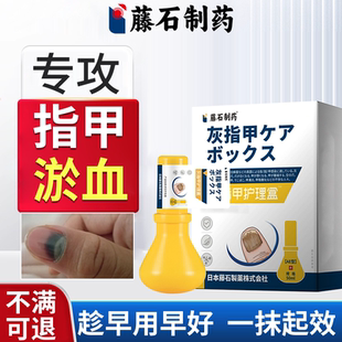 手指脚趾指甲被夹砸压伤盖淤血发黑发紫甲床受伤药监备案ZR