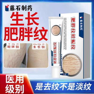 大腿生长纹去除肥胖学生青少年修复霜橄榄油消除淡化纹路膏ZR