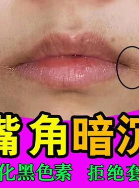 嘴角发黑去除嘴巴周边黑色素淡化唇纹改善唇周黑孩子舔嘴黑专用药