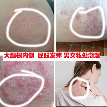 正品硫磺软膏身上痒都可用