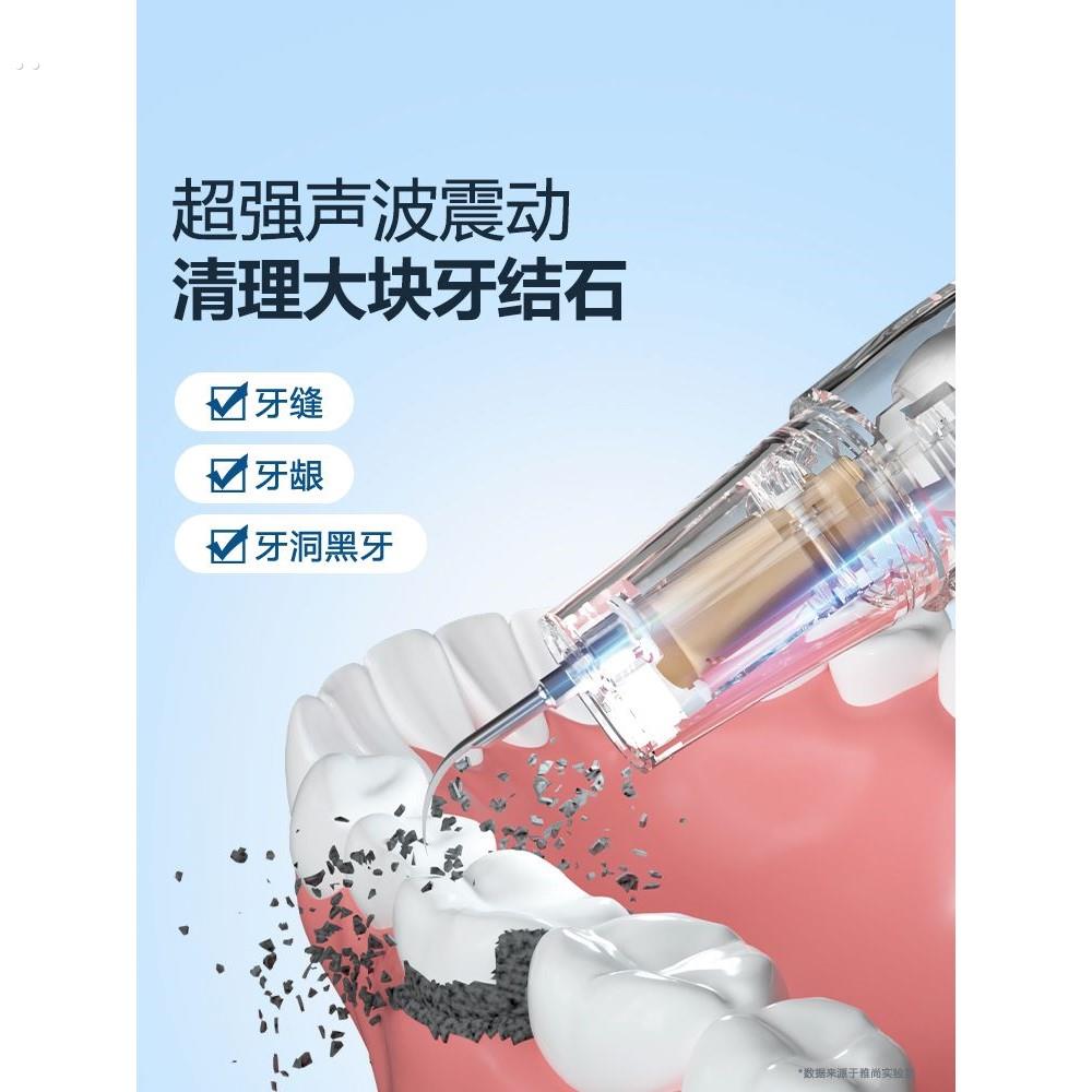 超声波洗牙器冲牙洁牙仪结石去除器洗牙齿污垢除牙石溶解速效家用