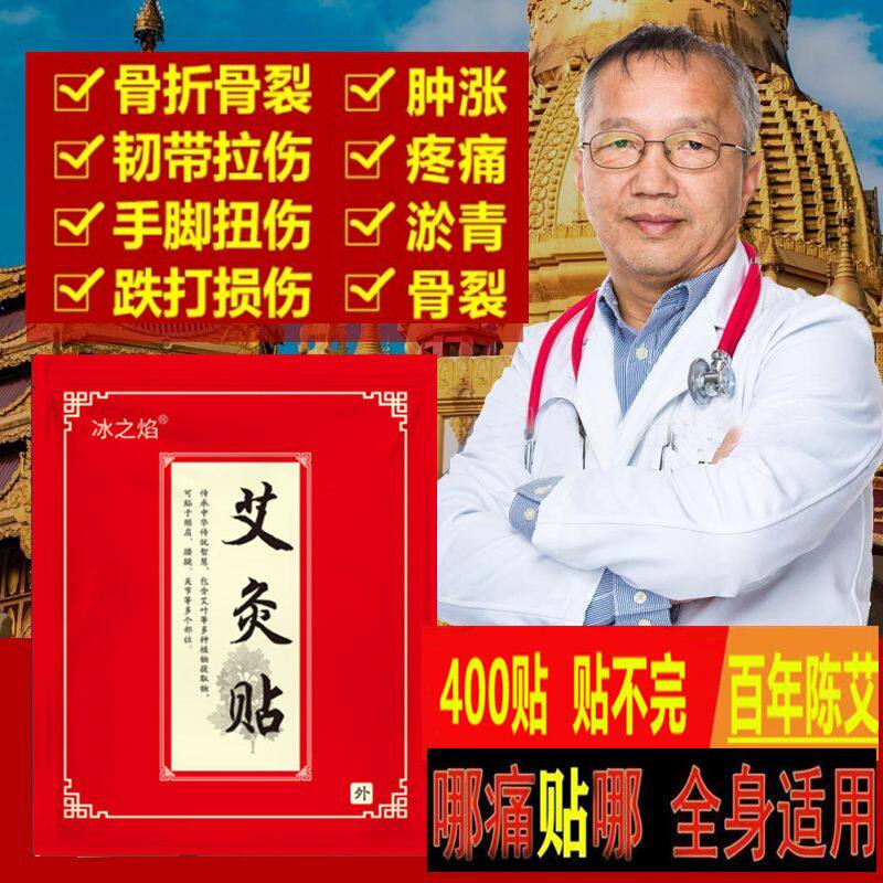 正品冰之焰艾灸贴100贴/袋膝盖关节贴颈椎艾灸贴发热姜贴肚脐艾草