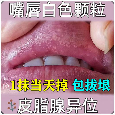 皮脂腺异位症去除嘴唇白点珍珠丘疹唇部粗糙干裂起皮起白点专用膏