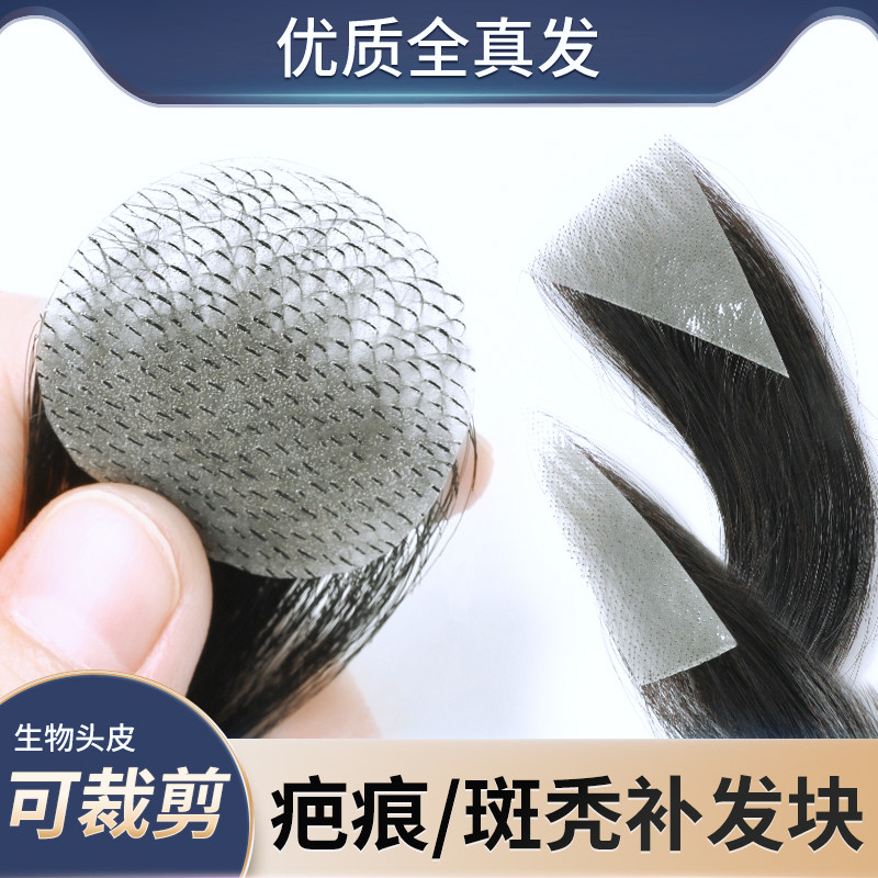 疤痕补发贴片头顶斑秃烧伤全真发补发片彷肤生物头皮遮秃假发片男