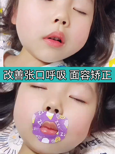 口呼吸矫正贴防张嘴闭嘴贴