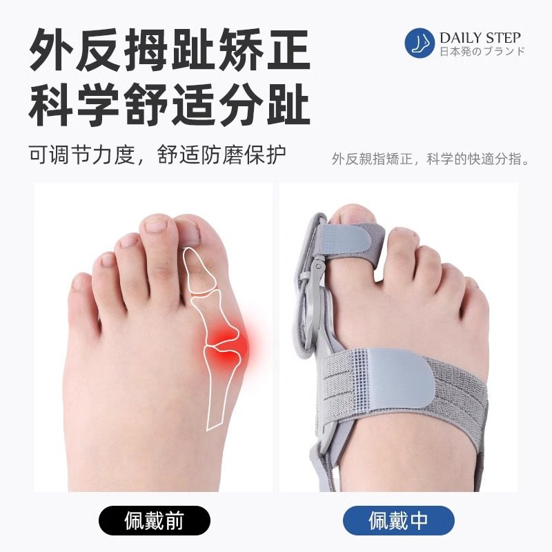 Gentle Bunion Relief: Adjustable Big Toe Corrector for Hallux Valgus - Product image 2