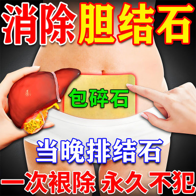 胆结石溶石化石排石专用药