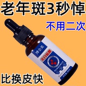 净斑太好用 除斑溶斑霜斑点黑色素色斑雀斑老年斑晒斑美白精华