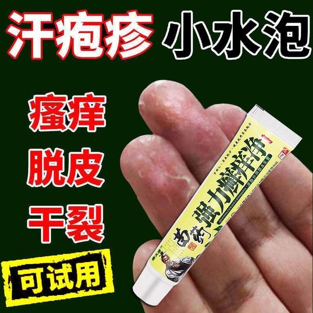 治汗疱疹药膏皮炎湿疹皮肤瘙痒去手足癣根手上长水泡