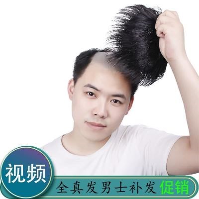 隐形发际线额头秃头白发头套头发谢顶男士假发补发片