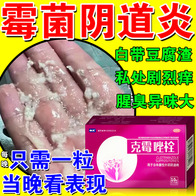 【中大】克霉唑栓0.15g*10粒/盒专治反复霉菌性克霉唑栓妇科外阴瘙痒专用止痒阴道炎