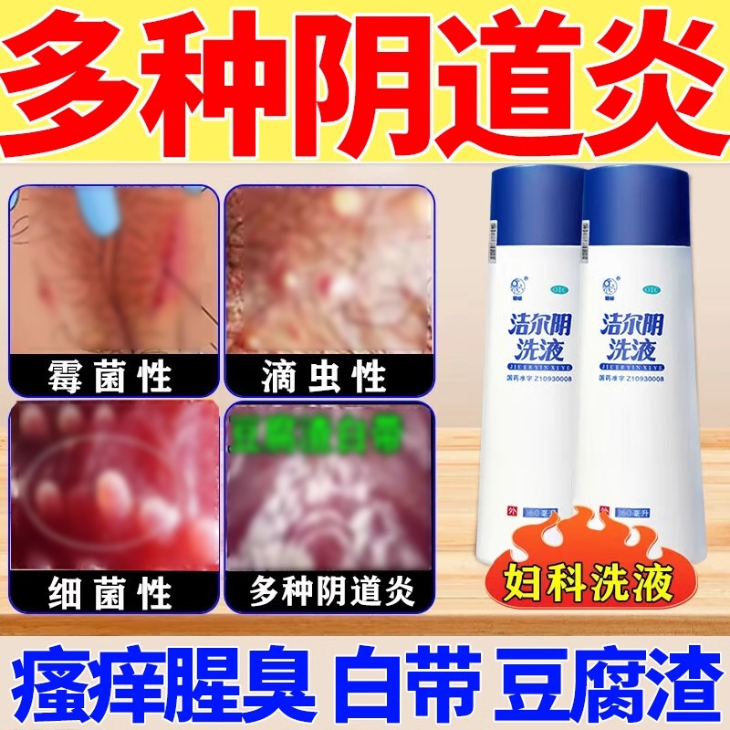 【恩威】洁尔阴洗液300ml/瓶妇炎洁洁尔阴洗剂阴部瘙痒阴道炎外阴瘙痒湿热