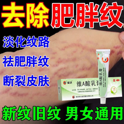 【臣功】维A酸乳膏0.025%*15g*1支/盒去肥胖纹妊娠纹生长纹修复医用乳膏