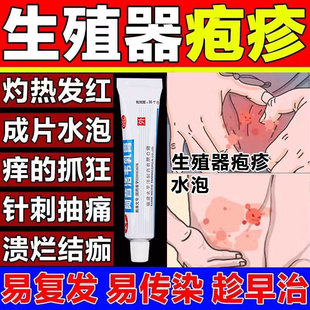 生殖器疱疹】瘙痒异味搭梅毒专用肿过敏交叉感染私处性病男女xl