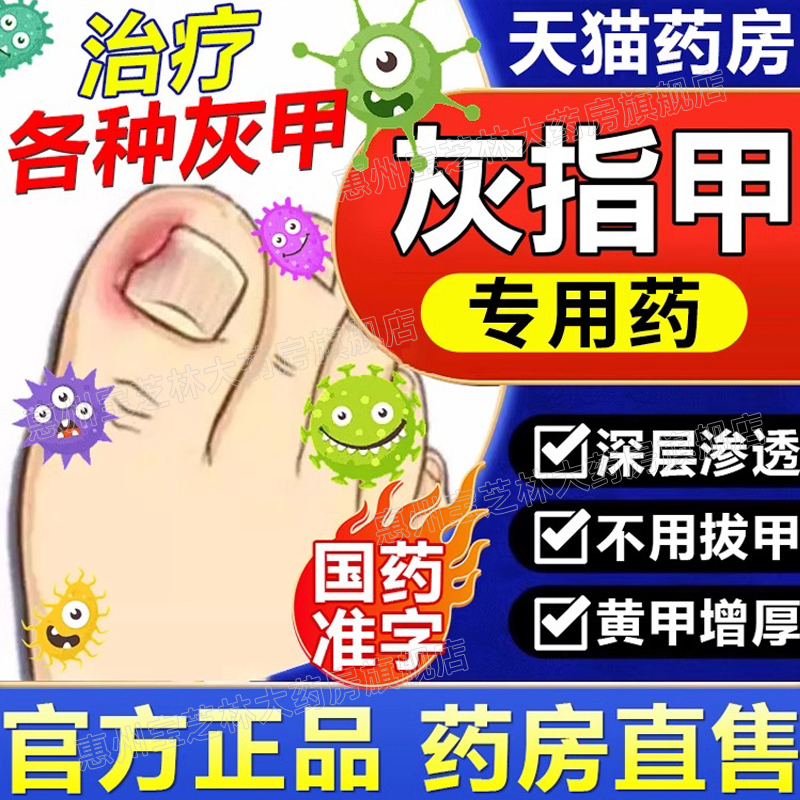 【扬子洲】硝酸咪康唑乳膏2%*20g*1支/盒