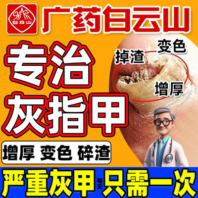 【白云山】硝酸益康唑乳膏20g*1支/盒【治疗灰指甲效果NO*1】