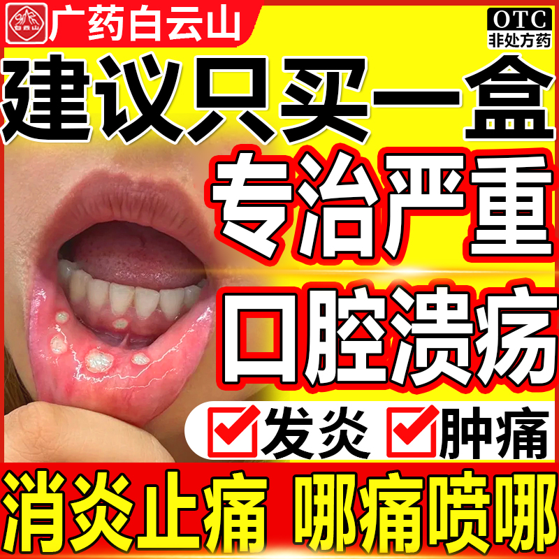 白云山口腔溃疡喷雾剂药水治舌头鹅口疮专用药上火消炎非特效WQ