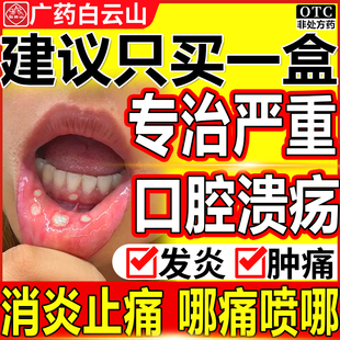 白云山口腔溃疡喷雾剂药水治舌头鹅口疮专用药上火消炎非特效WQ