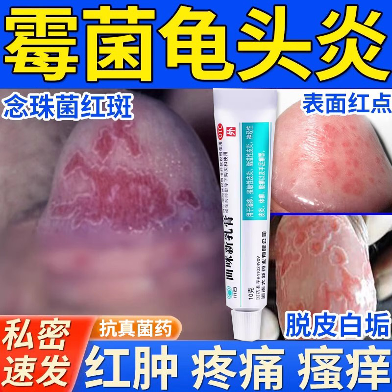 【川石】曲咪新乳膏10mg1mg3000IU*10g*1支/盒包皮炎抗菌抗炎抗过敏