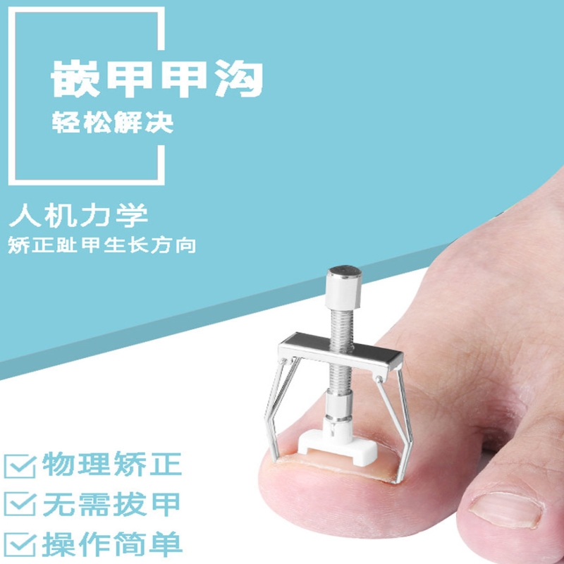 甲沟矫正器修脚神器指甲正甲扣纠正嵌甲脚趾甲长肉里专用指甲刀