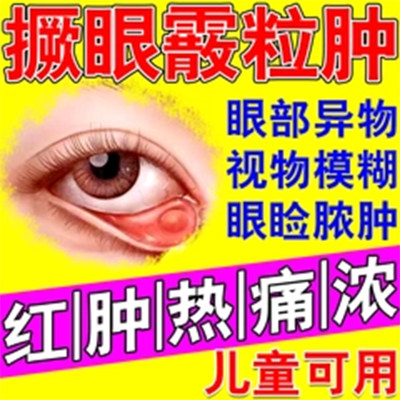金霉素眼药水皮肤疖肿眼睑炎睑缘麦粒肿细菌性结膜炎眼睑炎角膜炎
