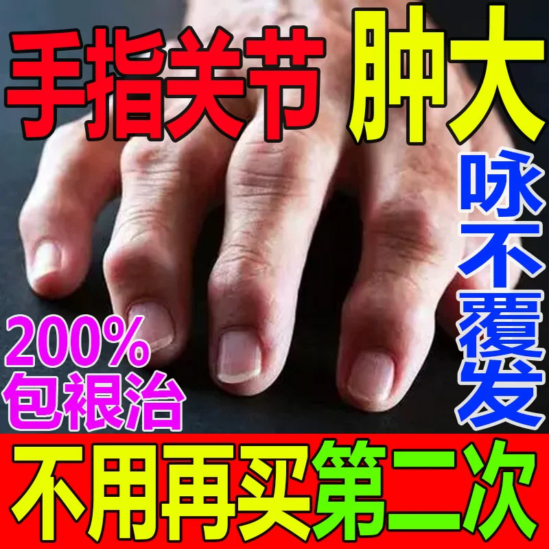 葵花双虎肿痛宁喷雾剂化瘀行气消肿止痛舒筋活络新版痛风特效药