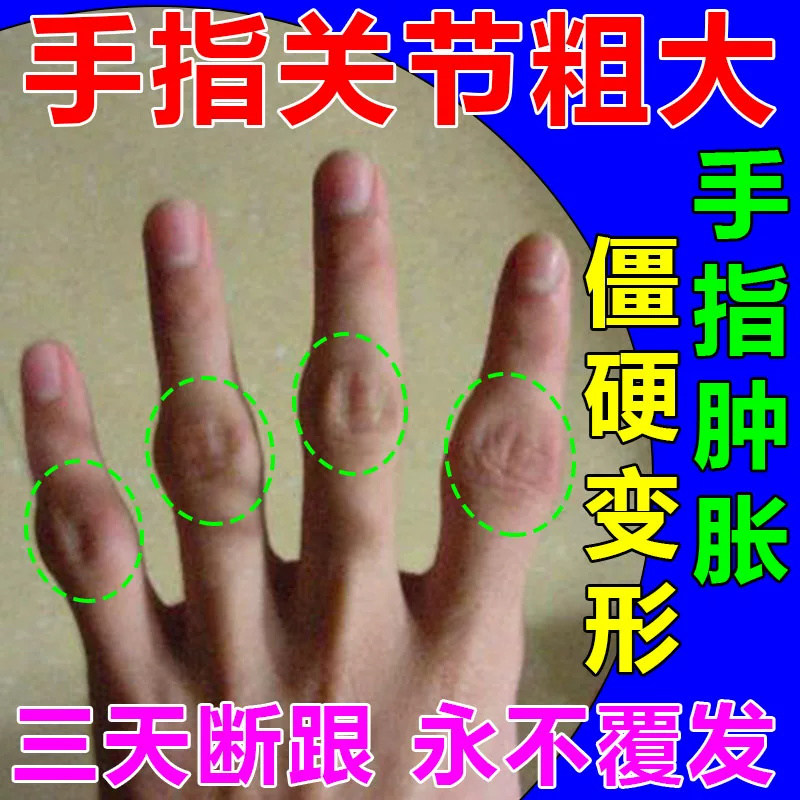 麝香追风膏百益风湿类手关节痛贴膏酸友痛风冷敷凝胶治疗腰腿疼痛