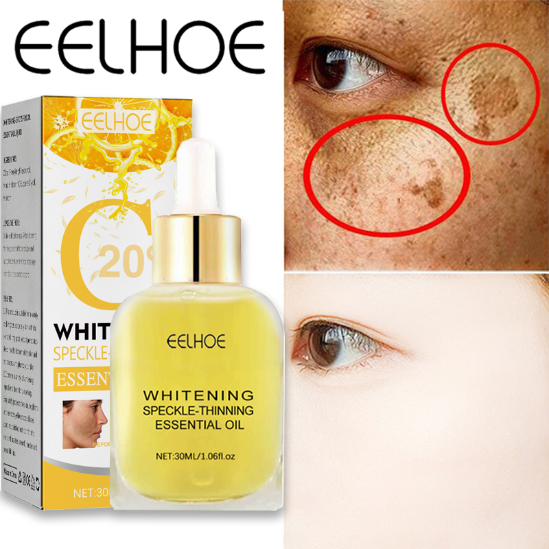 Body Dark Spot Remover Skin Spot Whitening Remove Facial Dar